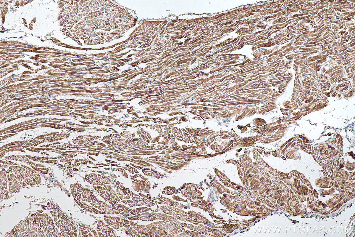 Immunohistochemical analysis of paraffin-embedded rat heart tissue slide using KHC0645 (NNT IHC Kit).