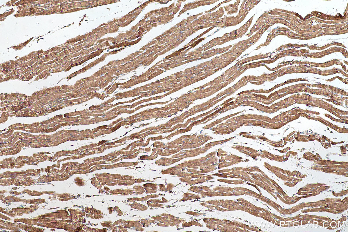 Immunohistochemical analysis of paraffin-embedded mouse heart tissue slide using KHC0645 (NNT IHC Kit).