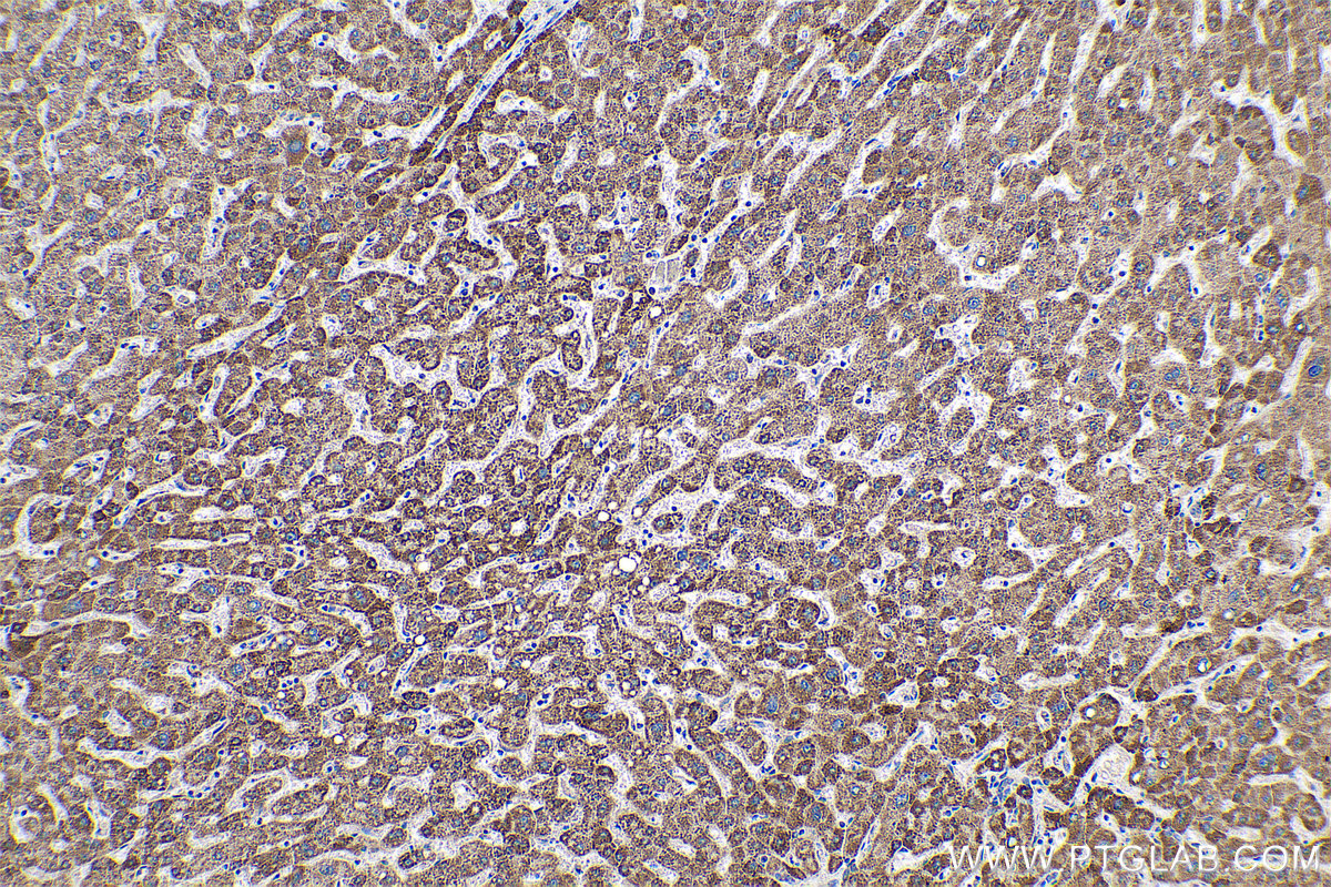 Immunohistochemical analysis of paraffin-embedded human liver tissue slide using KHC0645 (NNT IHC Kit).