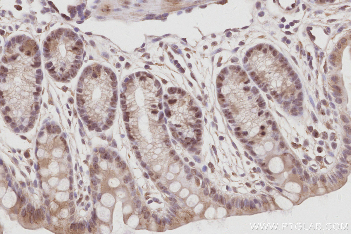 Immunohistochemical analysis of paraffin-embedded mouse colon tissue slide using KHC3067 (NOC2L IHC Kit). Immunohistochemical analysis of paraffin-embedded mouse colon tissue slide using KHC3067 (NOC2L IHC Kit).