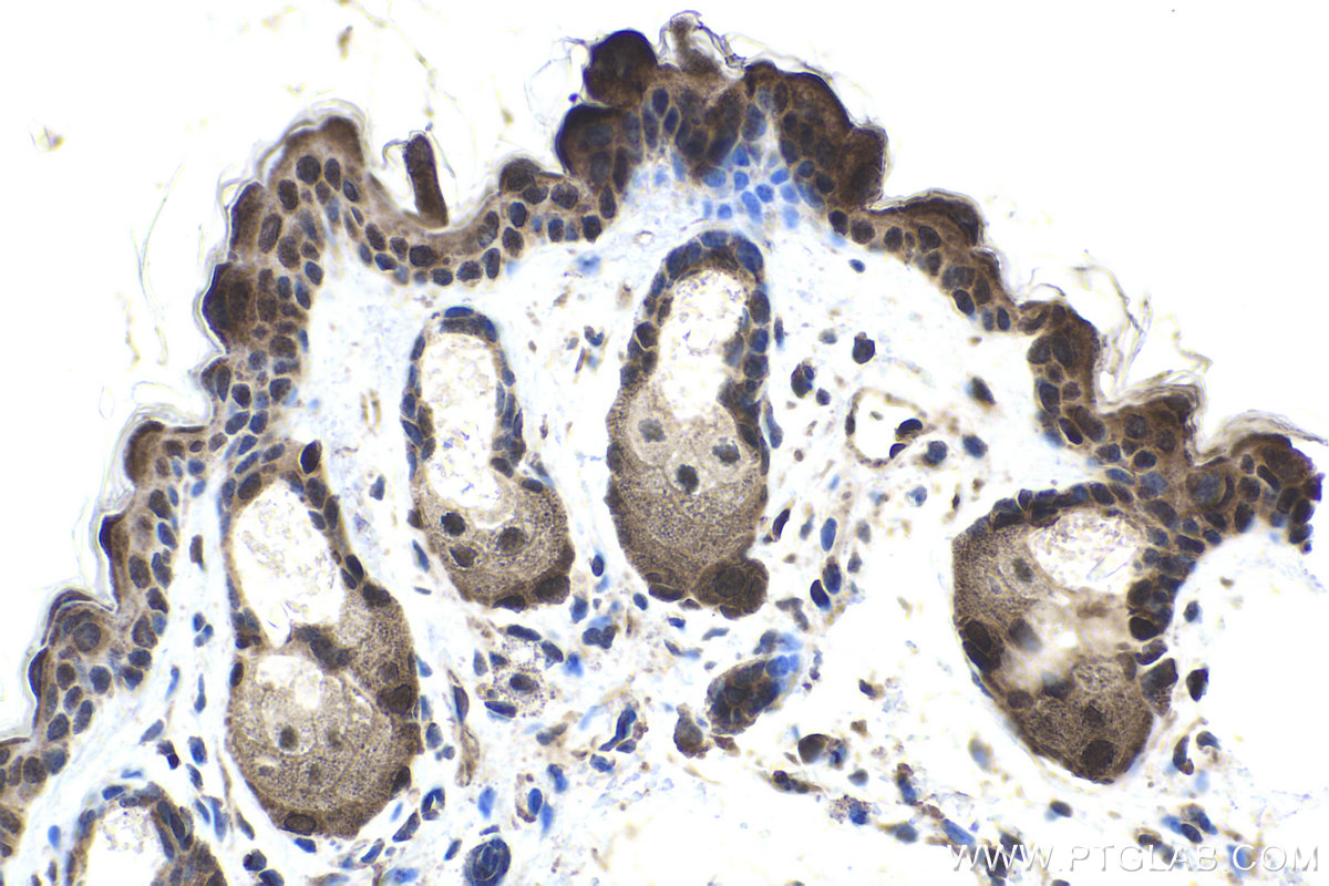 Immunohistochemical analysis of paraffin-embedded mouse skin tissue slide using KHC1743 (NOLC1 IHC Kit).