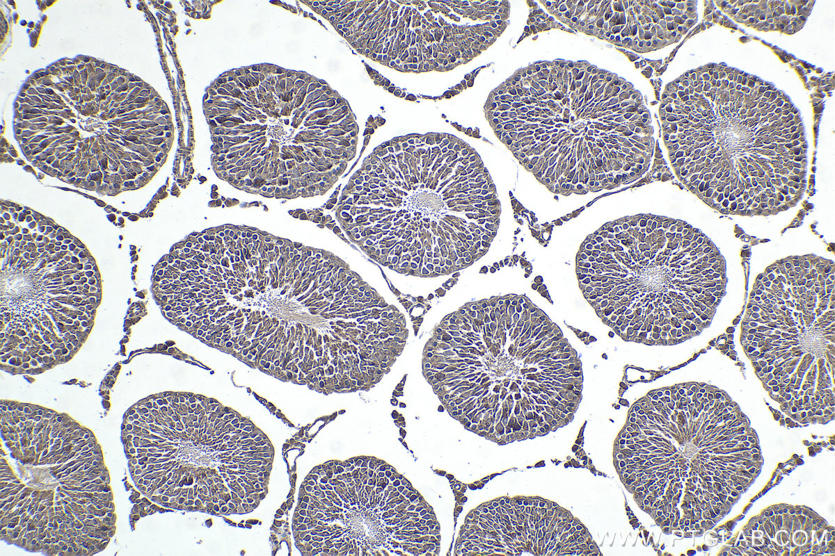Immunohistochemical analysis of paraffin-embedded rat testis tissue slide using KHC1743 (NOLC1 IHC Kit).