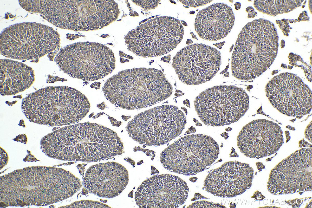 Immunohistochemical analysis of paraffin-embedded mouse testis tissue slide using KHC1743 (NOLC1 IHC Kit).