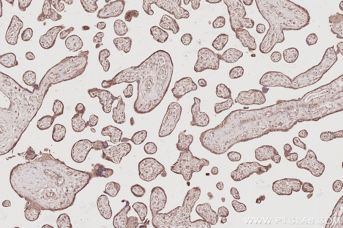 Immunohistochemical analysis of paraffin-embedded human placenta tissue slide using KHC3059 (NOSIP IHC Kit). Immunohistochemical analysis of paraffin-embedded human placenta tissue slide using KHC3059 (NOSIP IHC Kit).