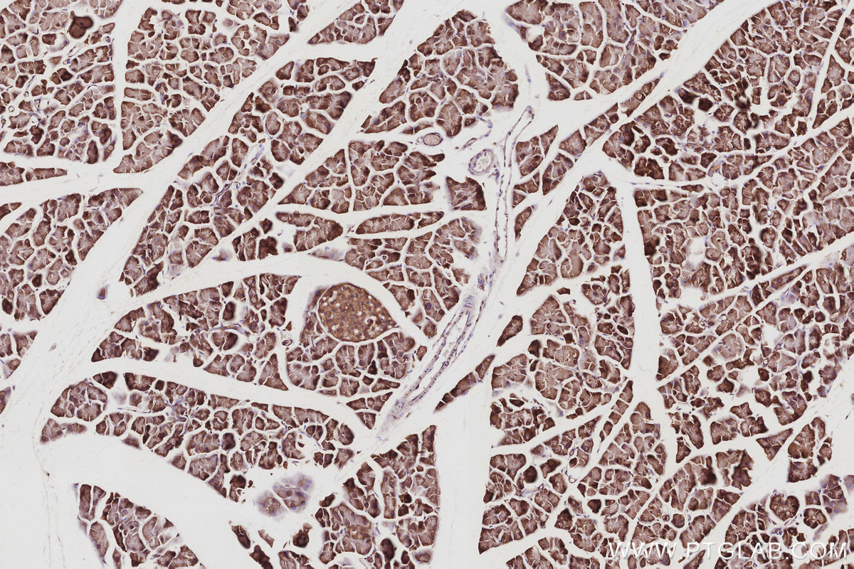Immunohistochemical analysis of paraffin-embedded mouse pancreas tissue slide using KHC3059 (NOSIP IHC Kit). Immunohistochemical analysis of paraffin-embedded mouse pancreas tissue slide using KHC3059 (NOSIP IHC Kit).