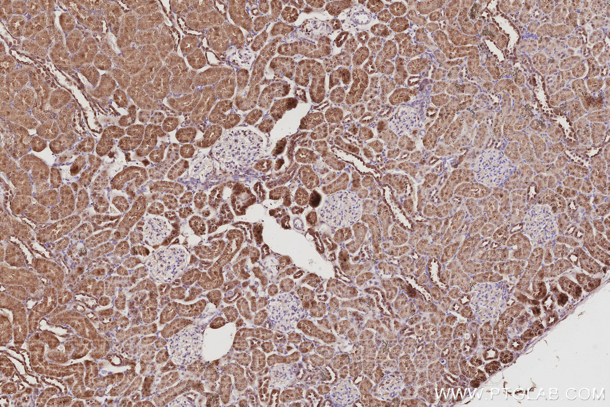 Immunohistochemical analysis of paraffin-embedded rat kidney tissue slide using KHC3059 (NOSIP IHC Kit). Immunohistochemical analysis of paraffin-embedded rat kidney tissue slide using KHC3059 (NOSIP IHC Kit).