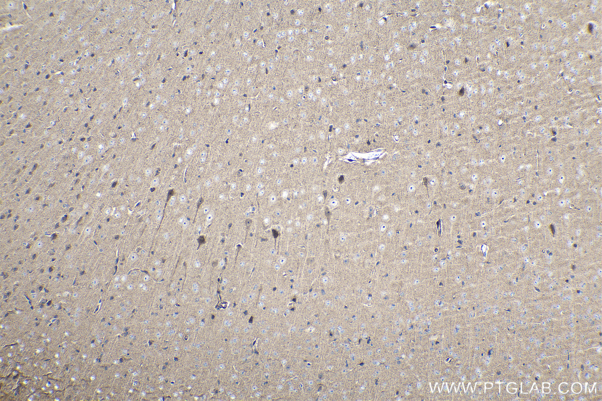 Immunohistochemical analysis of paraffin-embedded mouse brain tissue slide using KHC1061 (NOTCH1 IHC Kit).