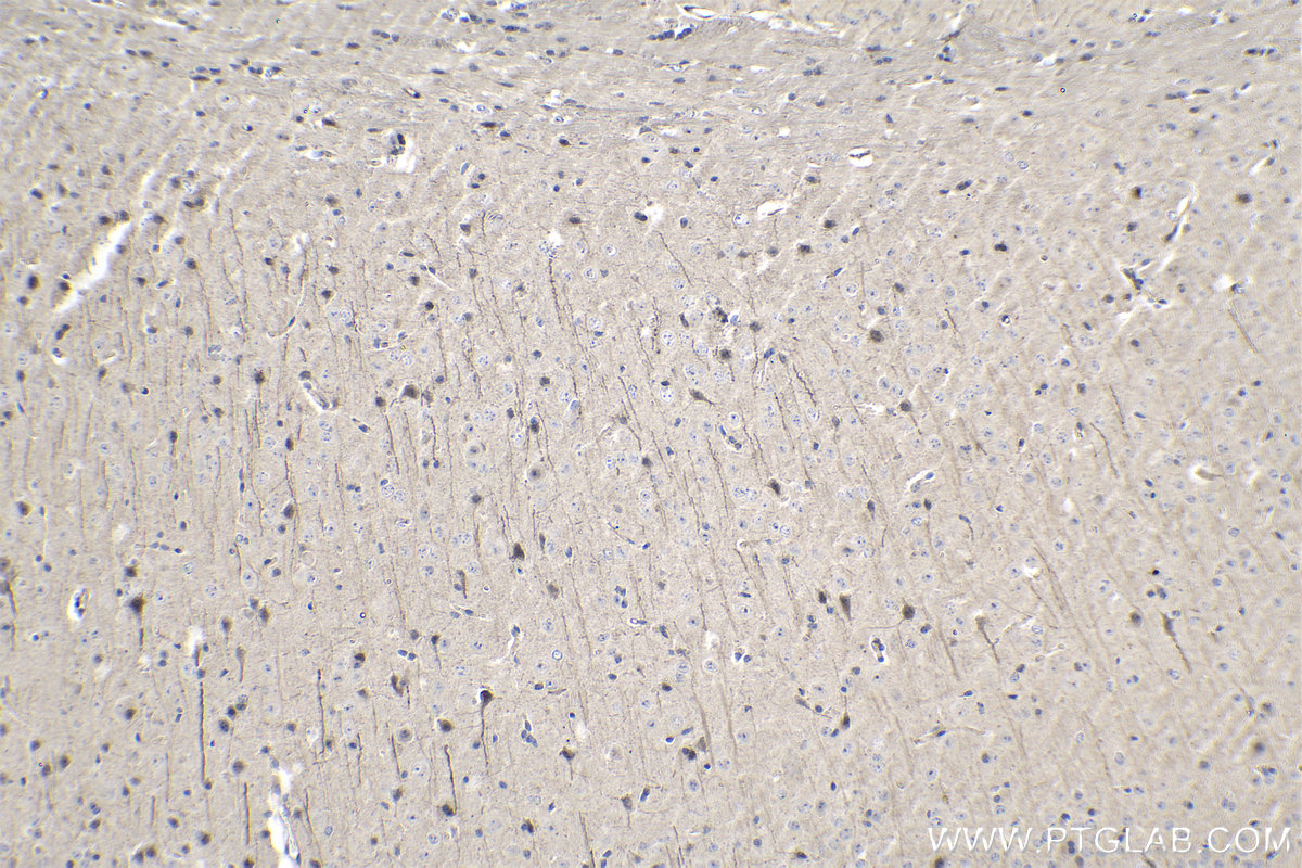 Immunohistochemical analysis of paraffin-embedded mouse brain tissue slide using KHC1062 (NOTCH2 IHC Kit).