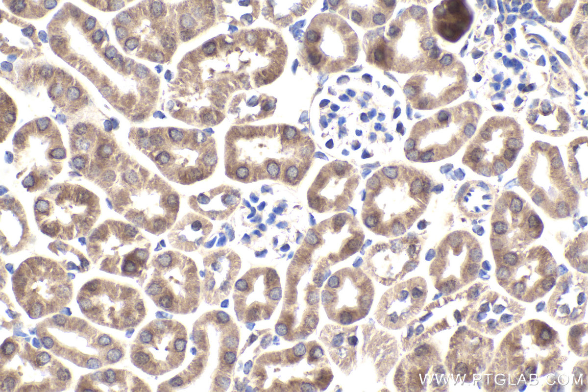 Immunohistochemical analysis of paraffin-embedded mouse kidney tissue slide using KHC1954 (NOX4 IHC Kit).