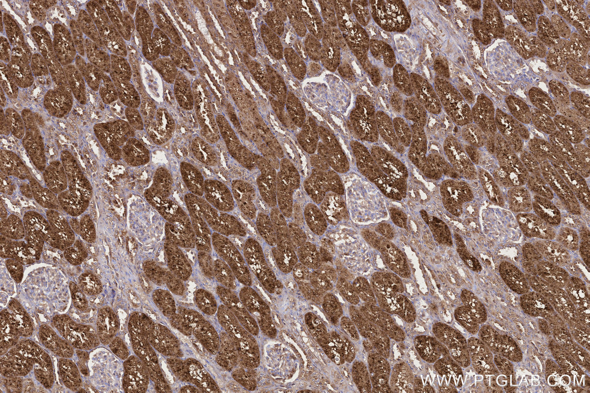 Immunohistochemical analysis of paraffin-embedded human kidney tissue slide using KHC3237 (NPC2 IHC Kit).
