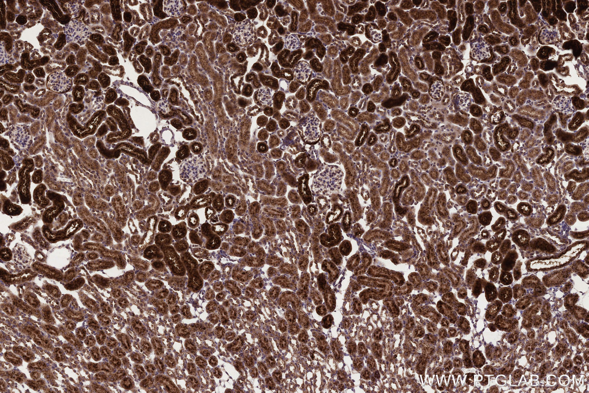 Immunohistochemical analysis of paraffin-embedded mouse kidney tissue slide using KHC3237 (NPC2 IHC Kit).