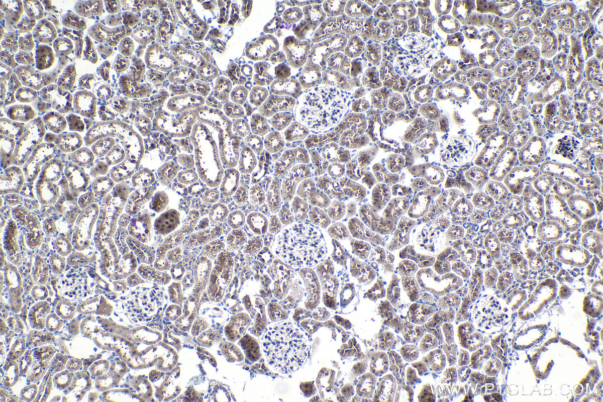 Immunohistochemical analysis of paraffin-embedded rat kidney tissue slide using KHC1004 (NPLOC4 IHC Kit).