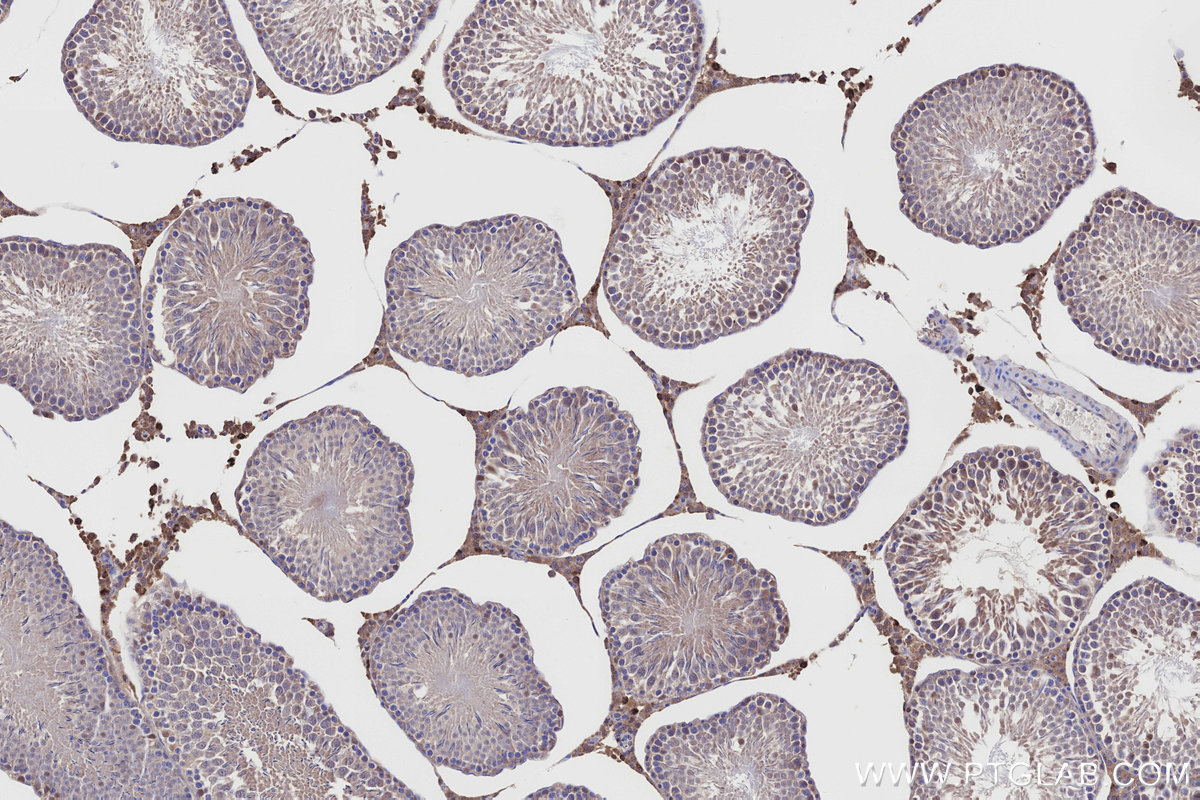 Immunohistochemical analysis of paraffin-embedded rat testis tissue slide using KHC3188 (NQO2 IHC Kit). Immunohistochemical analysis of paraffin-embedded rat testis tissue slide using KHC3188 (NQO2 IHC Kit).