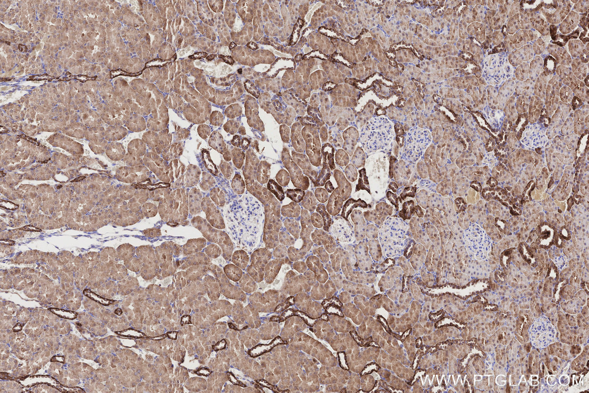 Immunohistochemical analysis of paraffin-embedded rat kidney tissue slide using KHC3188 (NQO2 IHC Kit). Immunohistochemical analysis of paraffin-embedded rat kidney tissue slide using KHC3188 (NQO2 IHC Kit).