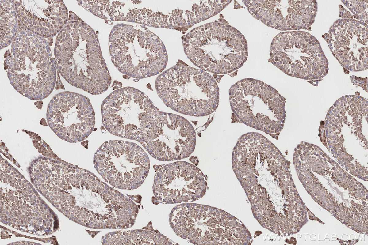 Immunohistochemical analysis of paraffin-embedded mouse testis tissue slide using KHC3188 (NQO2 IHC Kit). Immunohistochemical analysis of paraffin-embedded mouse testis tissue slide using KHC3188 (NQO2 IHC Kit).