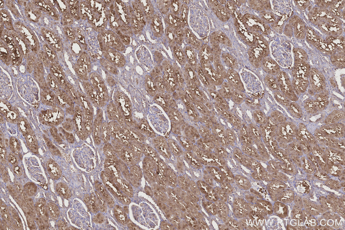 Immunohistochemical analysis of paraffin-embedded human kidney tissue slide using KHC3188 (NQO2 IHC Kit). Immunohistochemical analysis of paraffin-embedded human kidney tissue slide using KHC3188 (NQO2 IHC Kit).