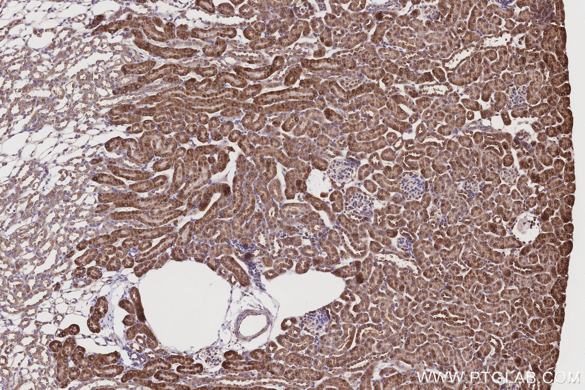 Immunohistochemical analysis of paraffin-embedded mouse kidney tissue slide using KHC3188 (NQO2 IHC Kit). Immunohistochemical analysis of paraffin-embedded mouse kidney tissue slide using KHC3188 (NQO2 IHC Kit).
