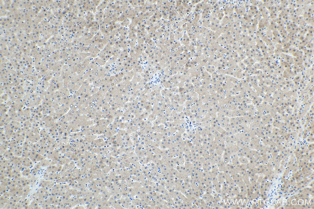 Immunohistochemical analysis of paraffin-embedded human liver tissue slide using KHC1744 (NR1I3 IHC Kit).