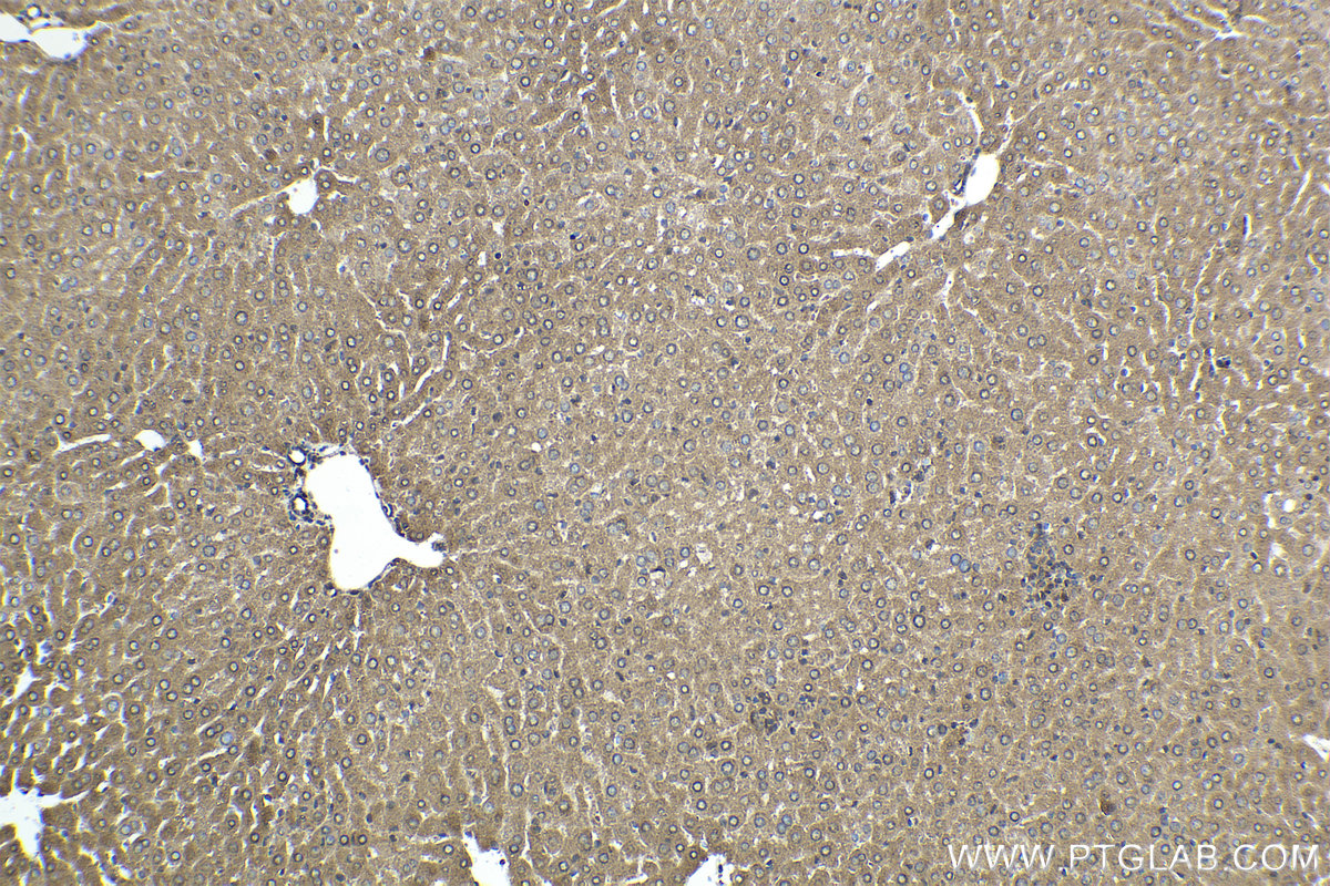 Immunohistochemical analysis of paraffin-embedded mouse liver tissue slide using KHC1744 (NR1I3 IHC Kit).