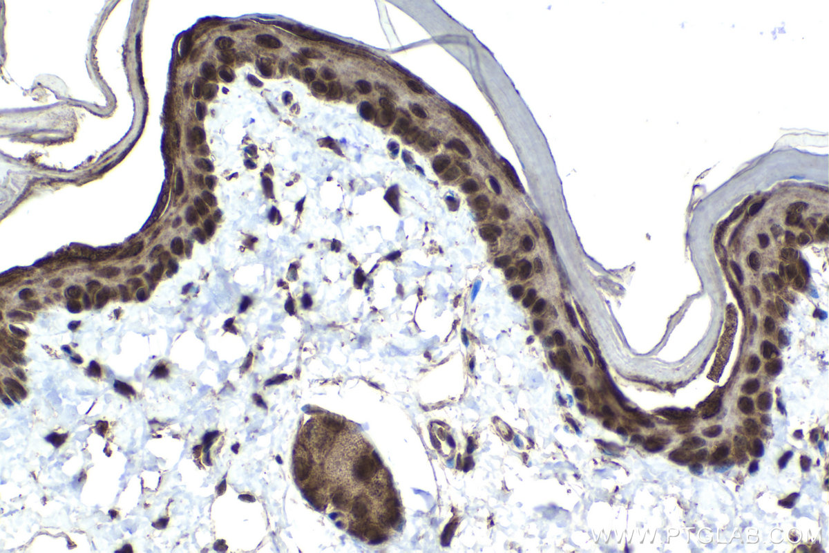 Immunohistochemical analysis of paraffin-embedded rat skin tissue slide using KHC1558 (NR4A1 IHC Kit).