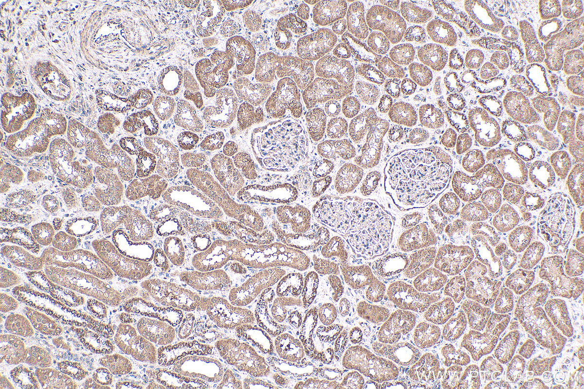 Immunohistochemical analysis of paraffin-embedded human kidney tissue slide using KHC0279 (NRAS IHC Kit).