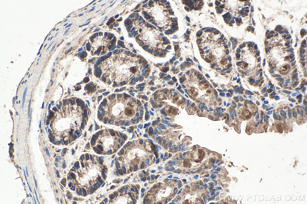 Immunohistochemical analysis of paraffin-embedded mouse colon tissue slide using KHC0279 (NRAS IHC Kit).