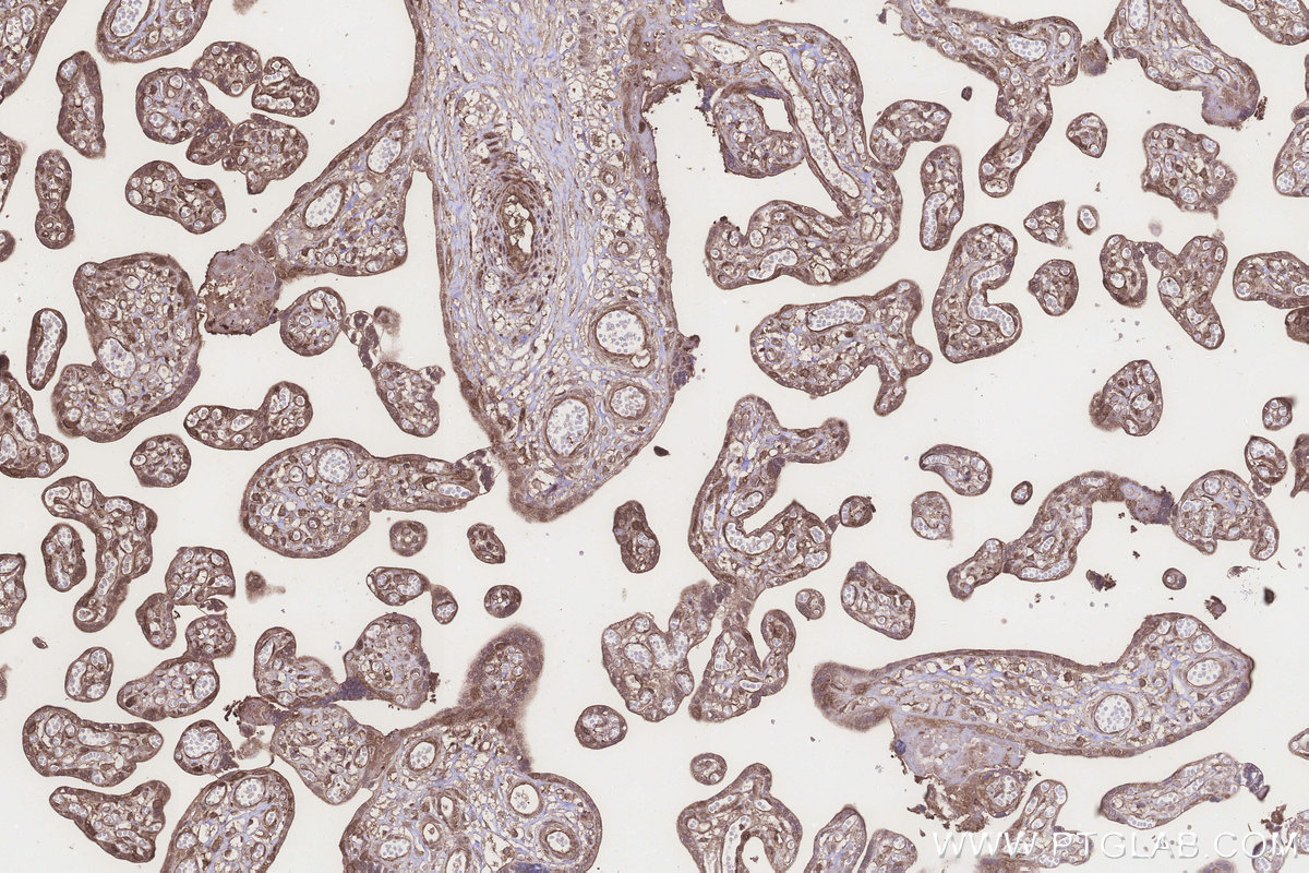 Immunohistochemical analysis of paraffin-embedded human placenta tissue slide using KHC3219 (NT5C2 IHC Kit). Immunohistochemical analysis of paraffin-embedded human placenta tissue slide using KHC3219 (NT5C2 IHC Kit).