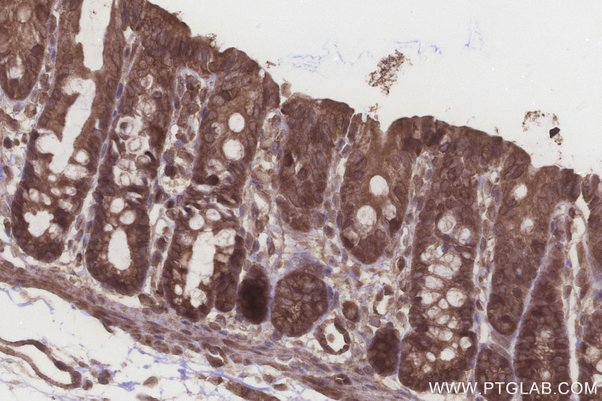Immunohistochemical analysis of paraffin-embedded rat colon tissue slide using KHC3219 (NT5C2 IHC Kit). Immunohistochemical analysis of paraffin-embedded rat colon tissue slide using KHC3219 (NT5C2 IHC Kit).