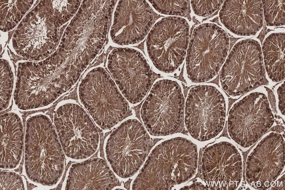 Immunohistochemical analysis of paraffin-embedded rat testis tissue slide using KHC3219 (NT5C2 IHC Kit). Immunohistochemical analysis of paraffin-embedded rat testis tissue slide using KHC3219 (NT5C2 IHC Kit).