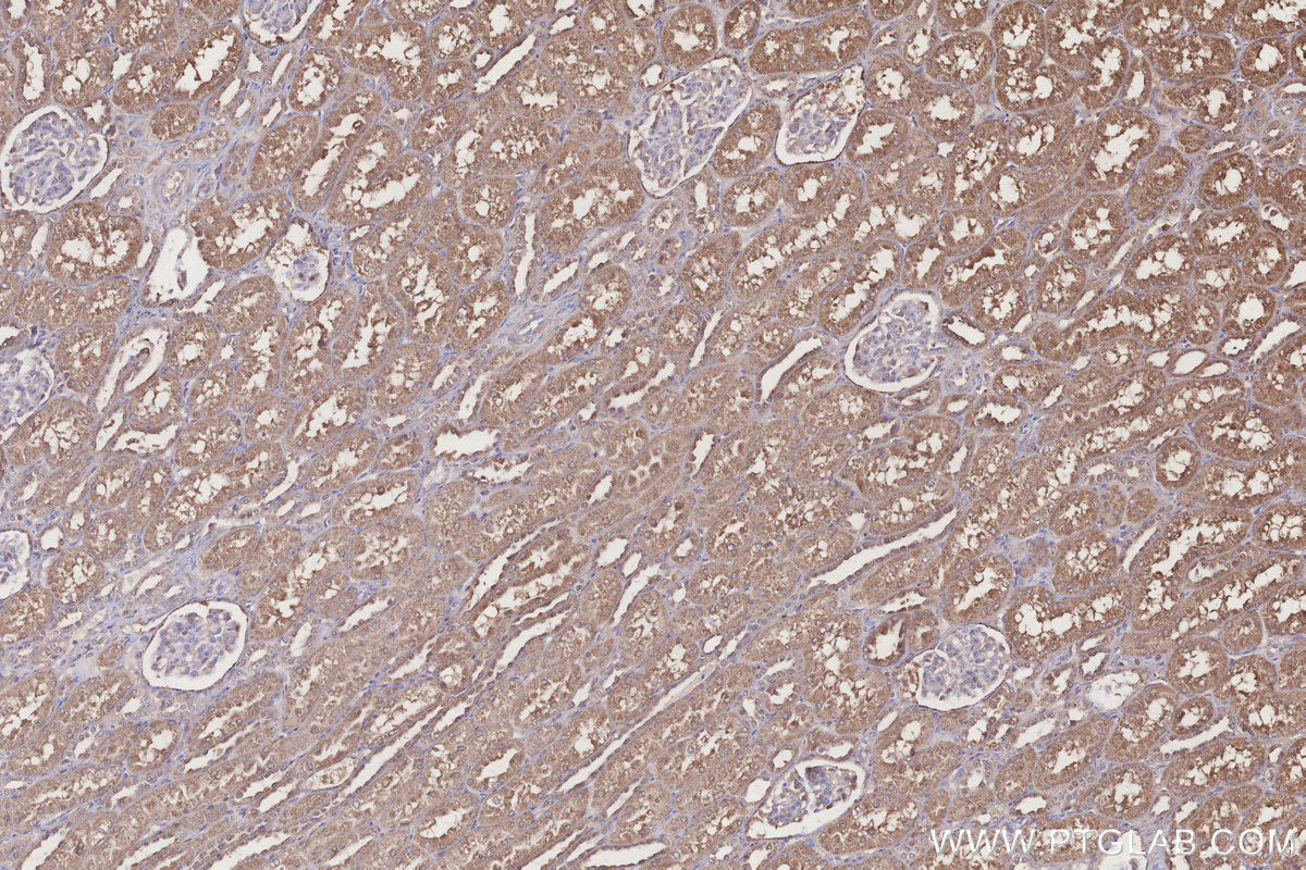 Immunohistochemical analysis of paraffin-embedded human kidney tissue slide using KHC3226 (NUBP1 IHC Kit).
