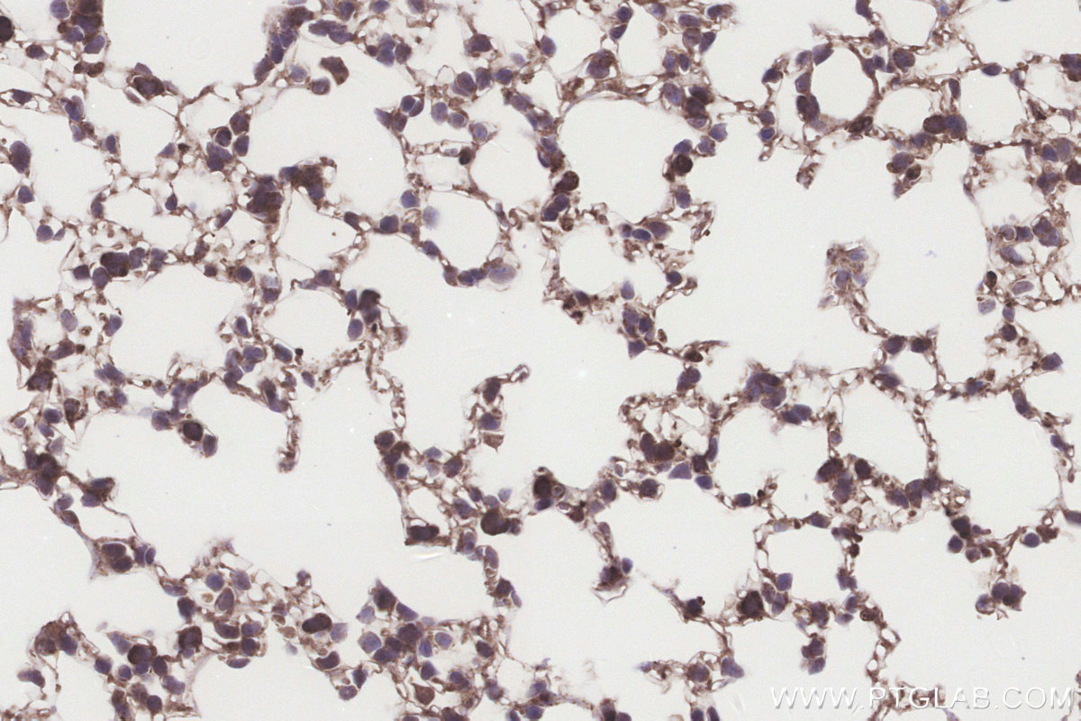 Immunohistochemical analysis of paraffin-embedded mouse lung tissue slide using KHC3226 (NUBP1 IHC Kit).