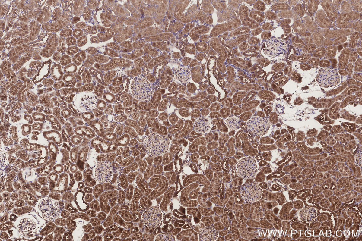 Immunohistochemical analysis of paraffin-embedded rat kidney tissue slide using KHC3226 (NUBP1 IHC Kit).