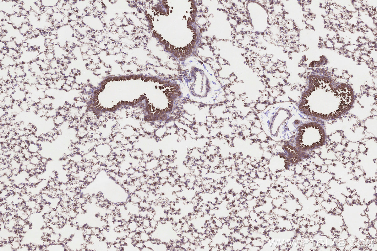 Immunohistochemical analysis of paraffin-embedded mouse lung tissue slide using KHC3301 (NUBPL IHC Kit). Immunohistochemical analysis of paraffin-embedded mouse lung tissue slide using KHC3301 (NUBPL IHC Kit).