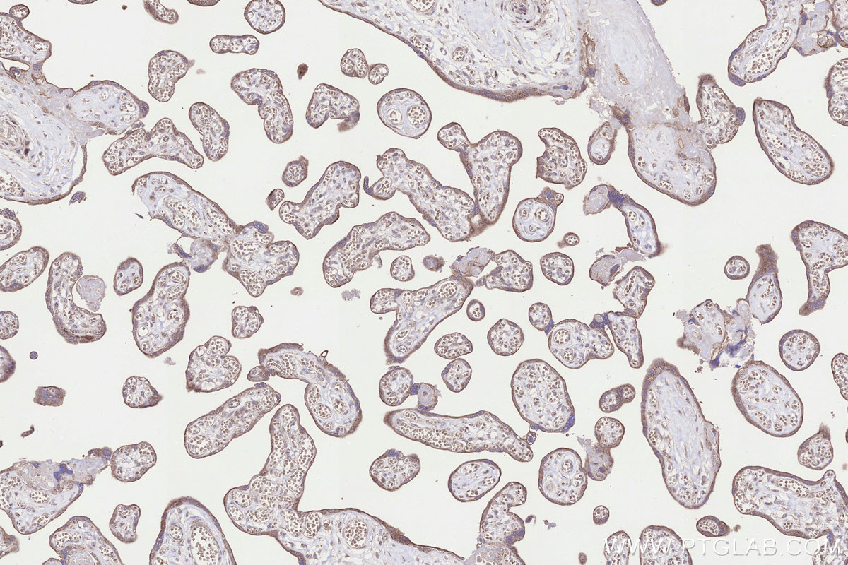Immunohistochemical analysis of paraffin-embedded human placenta tissue slide using KHC3301 (NUBPL IHC Kit). Immunohistochemical analysis of paraffin-embedded human placenta tissue slide using KHC3301 (NUBPL IHC Kit).