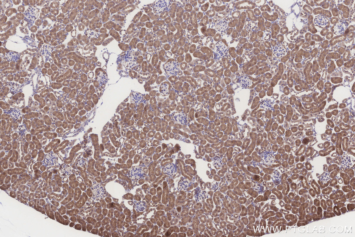 Immunohistochemical analysis of paraffin-embedded mouse kidney tissue slide using KHC3301 (NUBPL IHC Kit). Immunohistochemical analysis of paraffin-embedded mouse kidney tissue slide using KHC3301 (NUBPL IHC Kit).