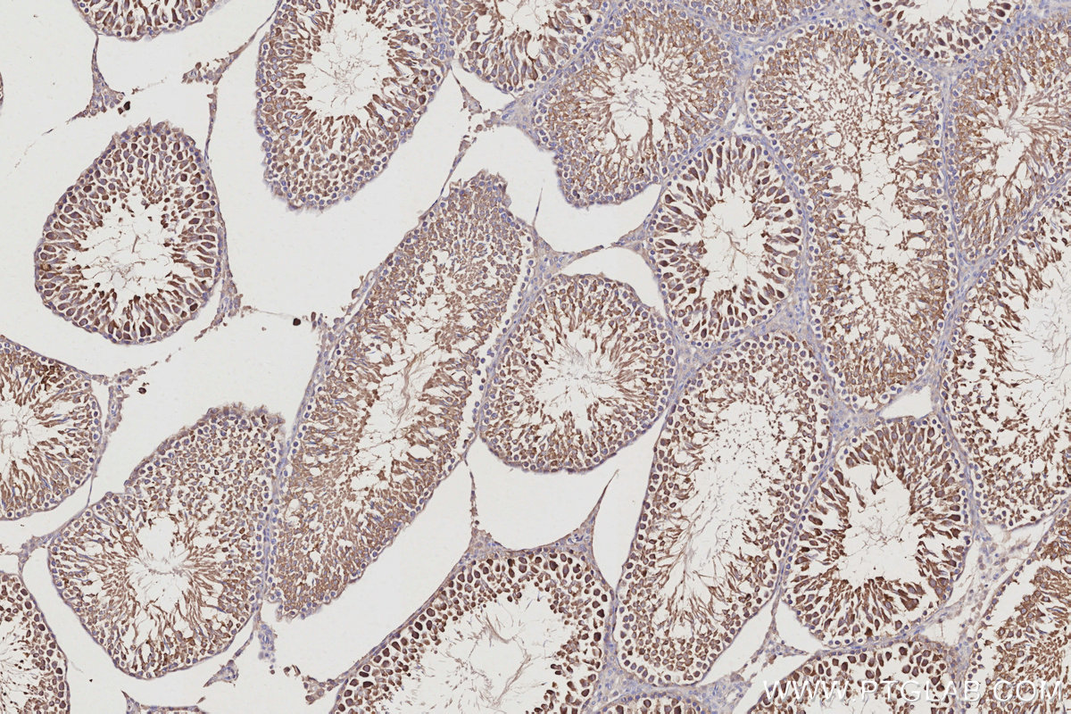 Immunohistochemical analysis of paraffin-embedded rat testis tissue slide using KHC3052 (NUDC IHC Kit).