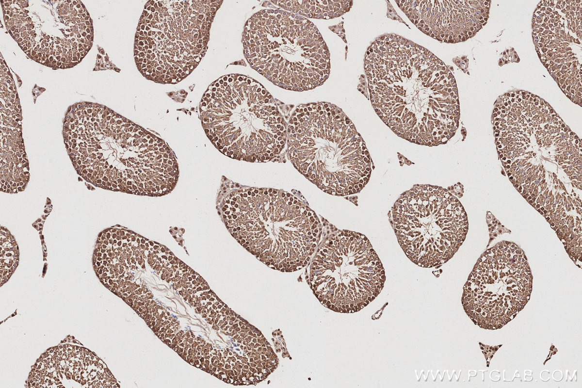 Immunohistochemical analysis of paraffin-embedded mouse testis tissue slide using KHC3052 (NUDC IHC Kit).