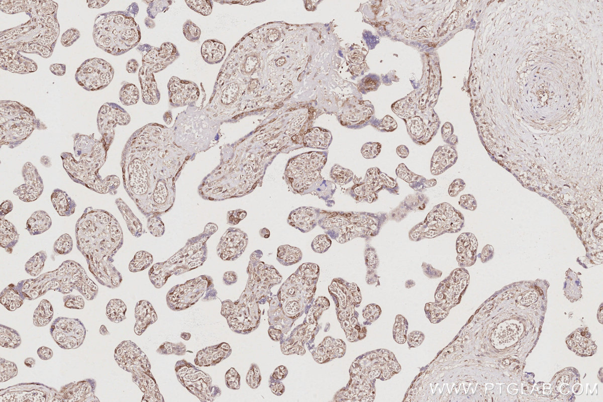 Immunohistochemical analysis of paraffin-embedded human placenta tissue slide using KHC3052 (NUDC IHC Kit).