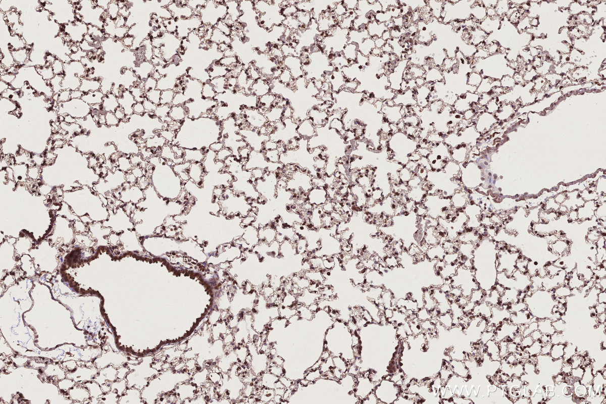 Immunohistochemical analysis of paraffin-embedded mouse lung tissue slide using KHC2786 (NUDT16 IHC Kit).