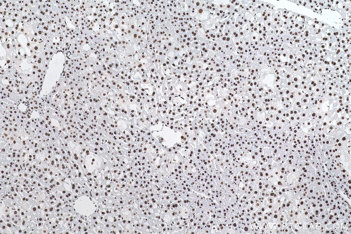 Immunohistochemical analysis of paraffin-embedded mouse liver tissue slide using KHC0870 (NUDT21 IHC Kit).