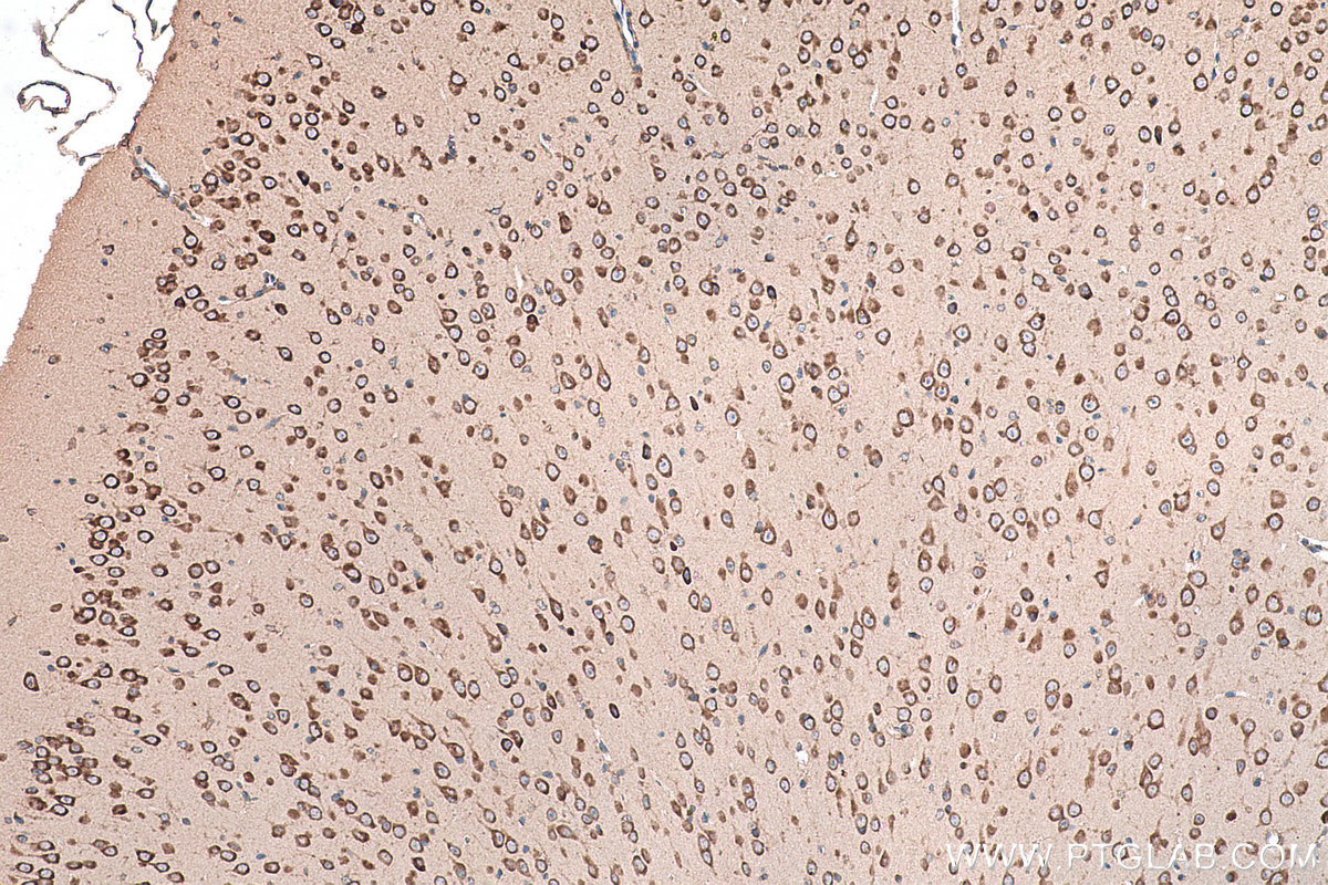 Immunohistochemical analysis of paraffin-embedded mouse brain tissue slide using KHC0958 (NUFIP2 IHC Kit).