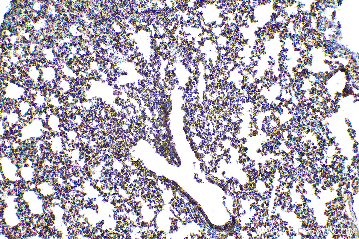 Immunohistochemical analysis of paraffin-embedded mouse lung tissue slide using KHC0958 (NUFIP2 IHC Kit).