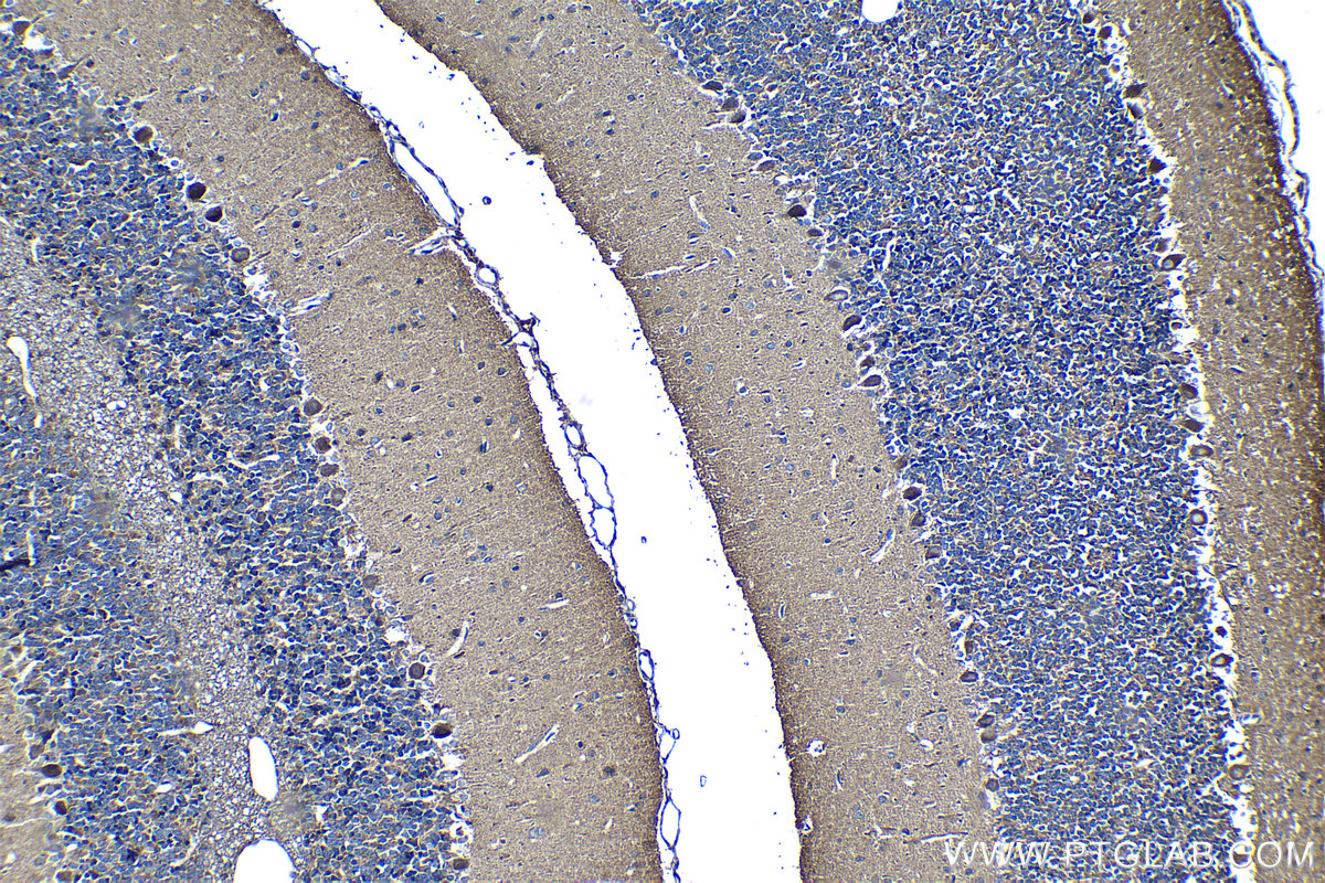 Immunohistochemical analysis of paraffin-embedded rat cerebellum tissue slide using KHC1269 (NUMBL IHC Kit).