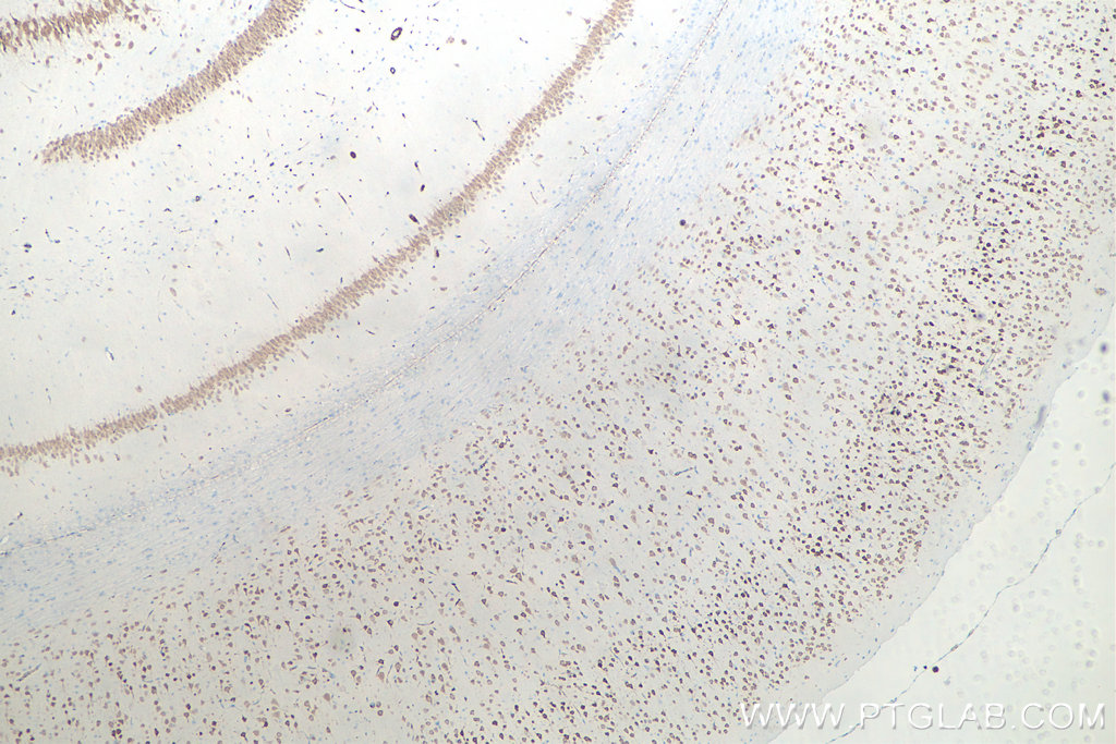 Immunohistochemical analysis of paraffin-embedded rat brain tissue slide using KHC0003 (NeuN IHC Kit).