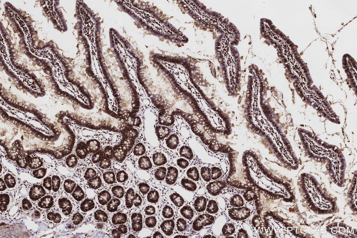Immunohistochemical analysis of paraffin-embedded rat small intestine tissue slide using KHC3168 (OAT IHC Kit).
