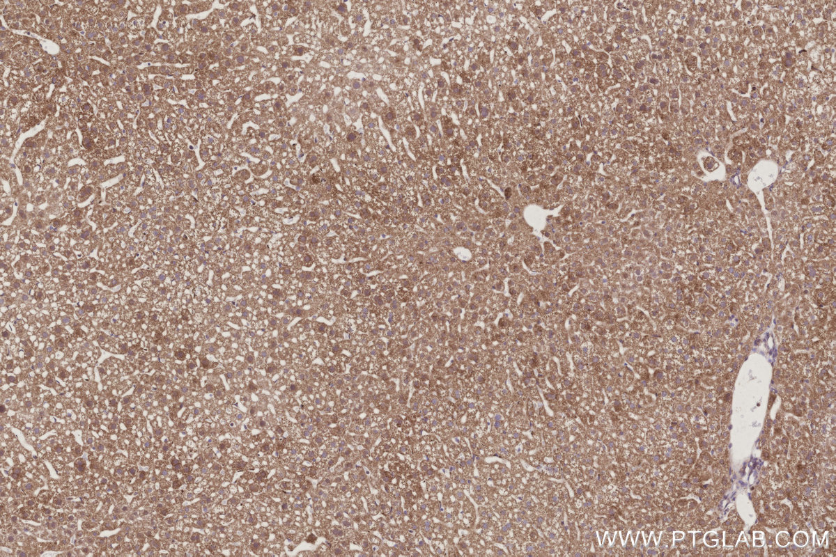 Immunohistochemical analysis of paraffin-embedded mouse liver tissue slide using KHC3034 (OGDHL IHC Kit).