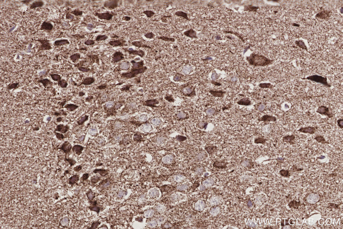Immunohistochemical analysis of paraffin-embedded mouse brain tissue slide using KHC3034 (OGDHL IHC Kit).