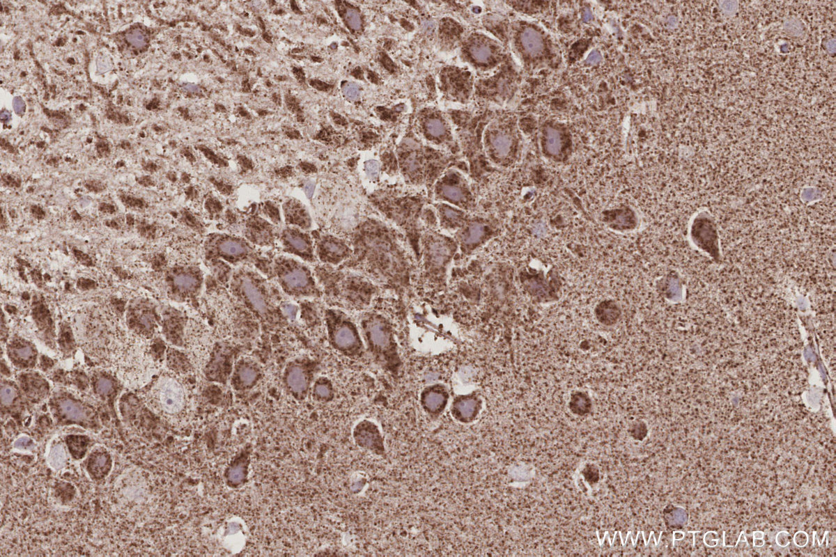 Immunohistochemical analysis of paraffin-embedded rat brain tissue slide using KHC3034 (OGDHL IHC Kit).