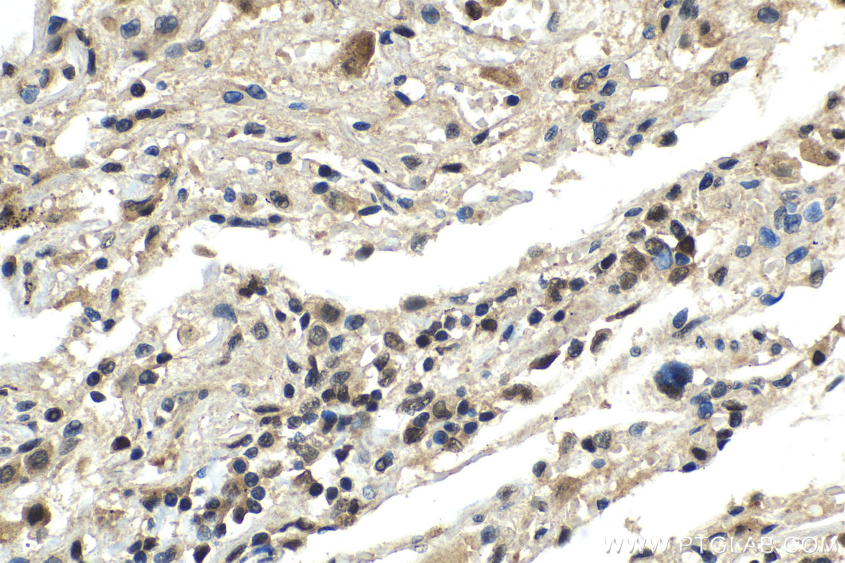 Immunohistochemical analysis of paraffin-embedded human lung tissue slide using KHC1442 (OGT IHC Kit).