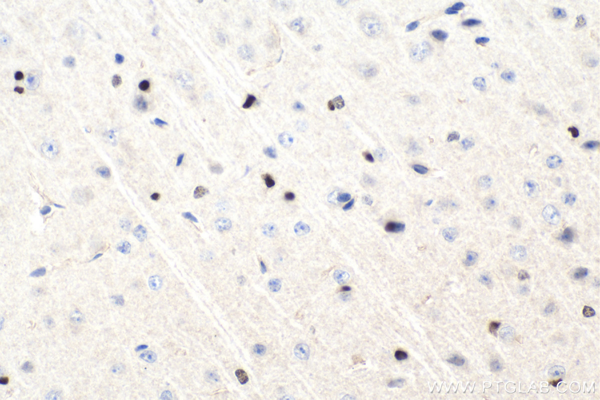 Immunohistochemical analysis of paraffin-embedded mouse brain tissue slide using KHC1715 (OLIG2 IHC Kit).